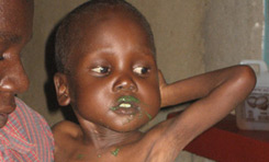 Photo of hungry child helped by IIMSAM
