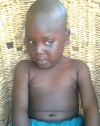 Child healing using spirulina