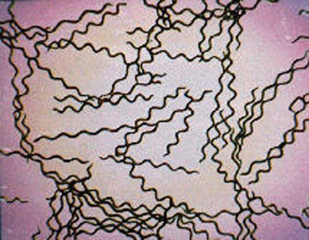 Microscope image of spirulina